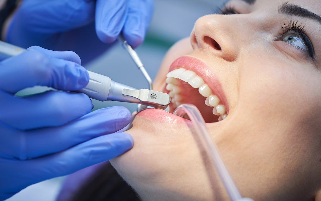 Regelmäßige Zahnarztbesuche gegen Mundhöhlenkrebs